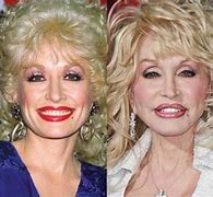 Image result for Dolly Parton Surgery List