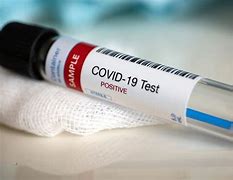 Image result for Covid Test-Tube