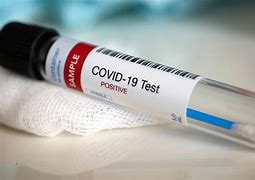 Image result for Covid 19 Swab Test
