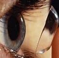 Image result for Contact Lens