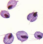 Image result for Trichomonas Under Microscope