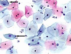 Image result for cytopatologia