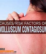 Image result for Molluscum Contagiosum in Adults Legs