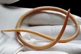 Image result for round worms pictures