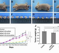 Image result for Tumor Size Measurement