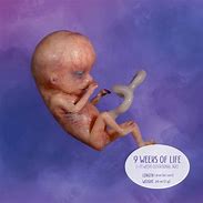 Image result for Baby at 9 Weeks in Womb