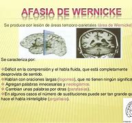 Image result for acefalizmo