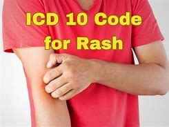 Image result for Viral Rash ICD-10