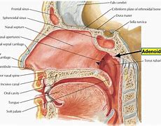 Image result for Where Are Tonsils and Adenoids Located