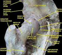 Image result for Bone Mineral Density of Right Femoral Neck
