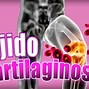 Image result for cartilaginoso