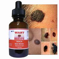 Image result for Skin Tag Mole Remover
