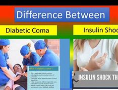Image result for Insulin Coma