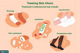 Image result for Chronic Ulcer of Skin