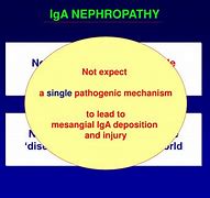 Image result for Chronic IGA Nephritis