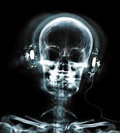 Image result for iPod X-ray