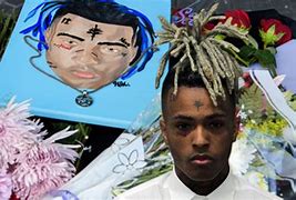 Image result for Xxxtentacion in the Hospital