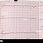 Image result for EKG