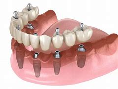 Image result for dental