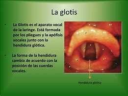 Image result for glotis