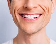 Image result for Male Smile Lines