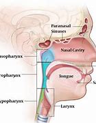 Image result for Head and Neck Cancer Diagram
