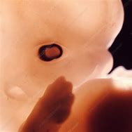 Image result for 5 Week Embryo Pictures