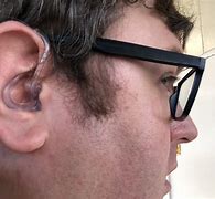 Image result for Non-Penetrating Hearing Aids