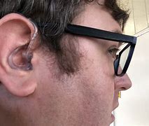Image result for Neo Hearing Aids