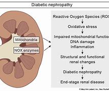 Image result for Diabéteszes Nephropathia