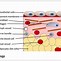 Image result for Squamous Cells in the Skin Diagram