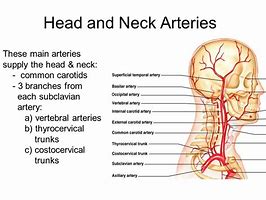 Image result for Arteries in Your Neck
