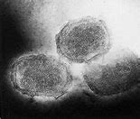 Image result for Molluscum Contagiosum Virus Pens