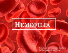 Image result for hemofilia