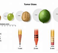 Image result for Tumor Sizes in mm