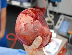 Image result for Equine Ovarian Tumor