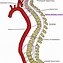 Image result for Medullary Branch of Vertebral Artery
