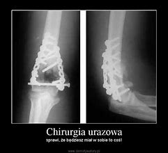 Image result for chirurgia_urazowa
