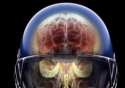 Image result for Football Concussion Brain Injury