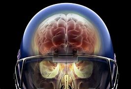 Image result for Football Head Injury