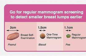 Image result for How Big Is an 8 Cm Tumor Image