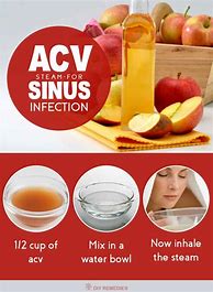Image result for Sinusitis Apple Cider Vinegar