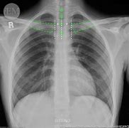 Image result for One Plus 8 X-ray Camera Clothes
