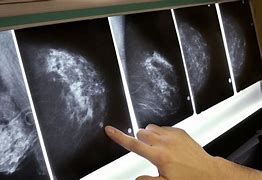 Image result for breast