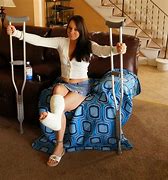 Image result for Daughter Arm Cast