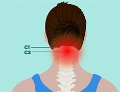 Image result for Cervical Spine Arthritis