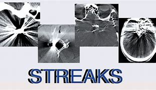 Image result for R Streak