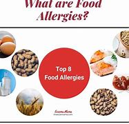 Image result for Types of Food Allergies
