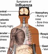 Image result for Causes of Cold and Flu