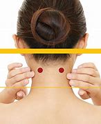 Image result for Acupuncture Neck